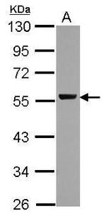 ALDH1A1 Antibody in Western Blot (WB)