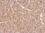 FHL1 Antibody in Immunohistochemistry (Paraffin) (IHC (P))