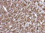 KIFC2 Antibody in Immunohistochemistry (Paraffin) (IHC (P))