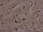 KIFC2 Antibody in Immunohistochemistry (Paraffin) (IHC (P))