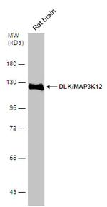 ZPK Antibody in Western Blot (WB)