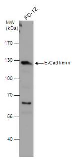 E-cadherin Antibody in Western Blot (WB)