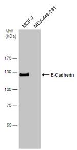 E-cadherin Antibody in Western Blot (WB)