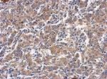 CTGF Antibody in Immunohistochemistry (Paraffin) (IHC (P))