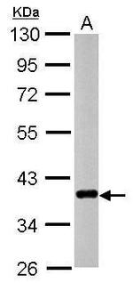 CTGF Antibody in Western Blot (WB)