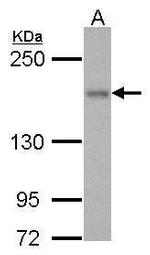 ROCK1 Antibody in Western Blot (WB)