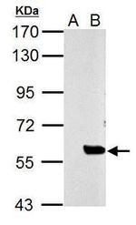 SLU7 Antibody in Western Blot (WB)