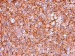 MYO1C Antibody in Immunohistochemistry (Paraffin) (IHC (P))