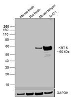 Cytokeratin 5 Antibody in Western Blot (WB)