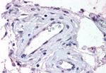 ADAMTS1 Antibody in Immunohistochemistry (Paraffin) (IHC (P))