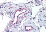 ADAMTS1 Antibody in Immunohistochemistry (Paraffin) (IHC (P))