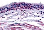 AHR Antibody in Immunohistochemistry (Paraffin) (IHC (P))