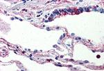 C5AR1 Antibody in Immunohistochemistry (Paraffin) (IHC (P))