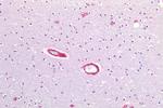 Caveolin 1 Antibody in Immunohistochemistry (Paraffin) (IHC (P))