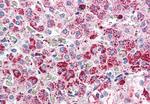 CCKAR Antibody in Immunohistochemistry (Paraffin) (IHC (P))