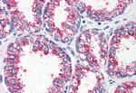 CCKAR Antibody in Immunohistochemistry (Paraffin) (IHC (P))