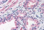 CCKAR Antibody in Immunohistochemistry (Paraffin) (IHC (P))