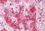 COMT Antibody in Immunohistochemistry (Paraffin) (IHC (P))