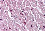 CYSLTR2 Antibody in Immunohistochemistry (Paraffin) (IHC (P))