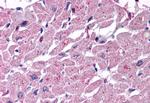 CYSLTR2 Antibody in Immunohistochemistry (Paraffin) (IHC (P))