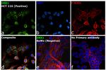 DKK1 Antibody