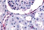 ErbB4 Antibody in Immunohistochemistry (Paraffin) (IHC (P))