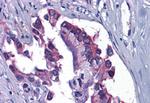 GFPT1 Antibody in Immunohistochemistry (Paraffin) (IHC (P))