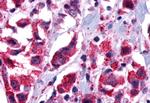 GPR101 Antibody in Immunohistochemistry (Paraffin) (IHC (P))