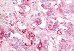 GPR182 Antibody in Immunohistochemistry (Paraffin) (IHC (P))