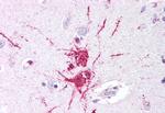 GPR52 Antibody in Immunohistochemistry (Paraffin) (IHC (P))