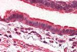 GPR98 Antibody in Immunohistochemistry (Paraffin) (IHC (P))