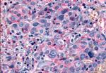 mGluR6 Antibody in Immunohistochemistry (Paraffin) (IHC (P))