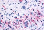 mGluR6 Antibody in Immunohistochemistry (Paraffin) (IHC (P))