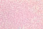 INSR Antibody in Immunohistochemistry (Paraffin) (IHC (P))