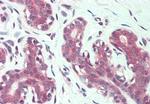 CD49f Antibody in Immunohistochemistry (Paraffin) (IHC (P))