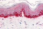 ITGB1 Antibody in Immunohistochemistry (Paraffin) (IHC (P))