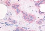 VEGF Receptor 2 Antibody in Immunohistochemistry (Paraffin) (IHC (P))