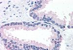 LOXL2 Antibody in Immunohistochemistry (Paraffin) (IHC (P))