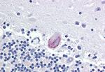 LPCAT1 Antibody in Immunohistochemistry (Paraffin) (IHC (P))