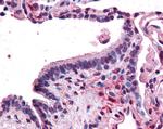 MFI2 Antibody in Immunohistochemistry (Paraffin) (IHC (P))