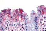 RON Antibody in Immunohistochemistry (Paraffin) (IHC (P))