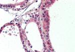 NR1D2 Antibody in Immunohistochemistry (Paraffin) (IHC (P))