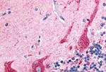 PKC zeta Antibody in Immunohistochemistry (Paraffin) (IHC (P))