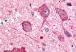 PKC zeta Antibody in Immunohistochemistry (Paraffin) (IHC (P))