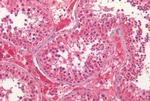 PTGES Antibody in Immunohistochemistry (Paraffin) (IHC (P))