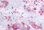 RARB Antibody in Immunohistochemistry (Paraffin) (IHC (P))