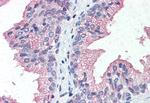 ZIP14 Antibody in Immunohistochemistry (Paraffin) (IHC (P))