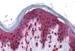 SLC5A6 Antibody in Immunohistochemistry (Paraffin) (IHC (P))