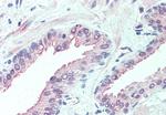 SLITRK6 Antibody in Immunohistochemistry (Paraffin) (IHC (P))