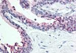 STEAP2 Antibody in Immunohistochemistry (Paraffin) (IHC (P))